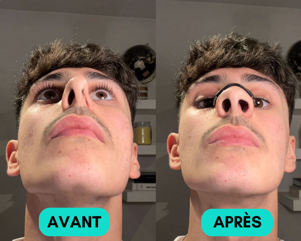 Bande nasale magnétique KAVARA